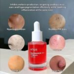 Anua serum - niaciamamide and tranexamic acid